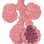 An illustration of an alveolus.